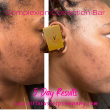 Load image into Gallery viewer, Correction Bar