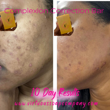 Load image into Gallery viewer, Correction Bar