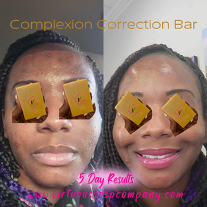 Correction Bar